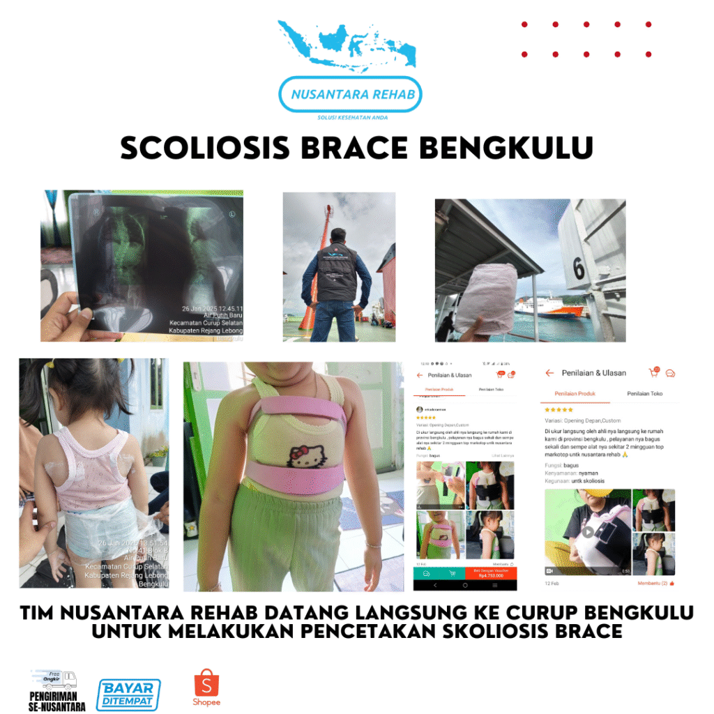 SKOLIOSIS BRACE NUSANTARA REHAB