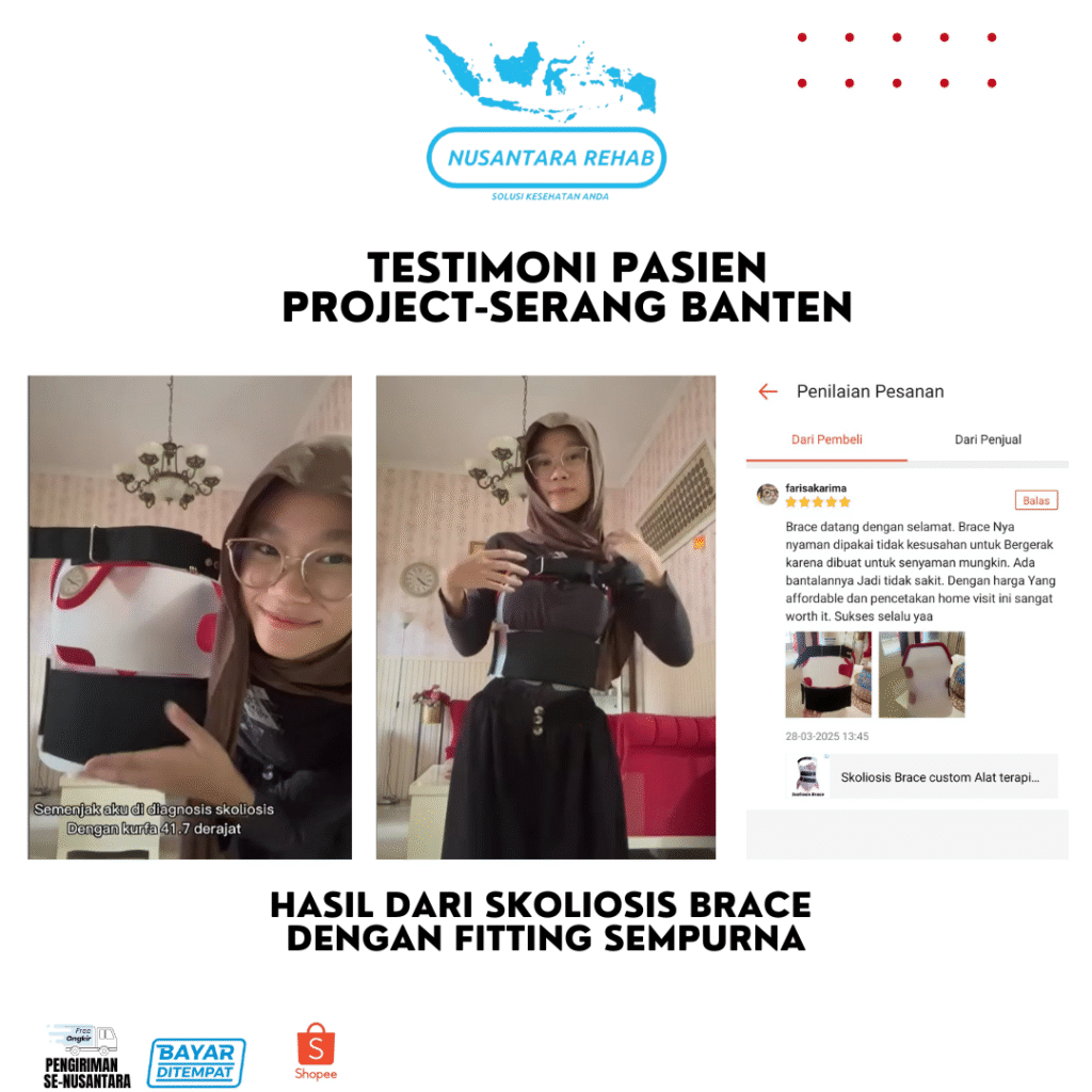 SKOLIOSIS BRACE NUSANTARA REHAB