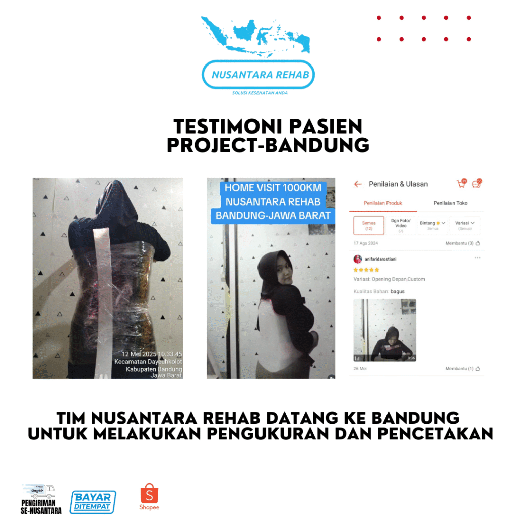 SKOLIOSIS BRACE NUSANTARA REHAB