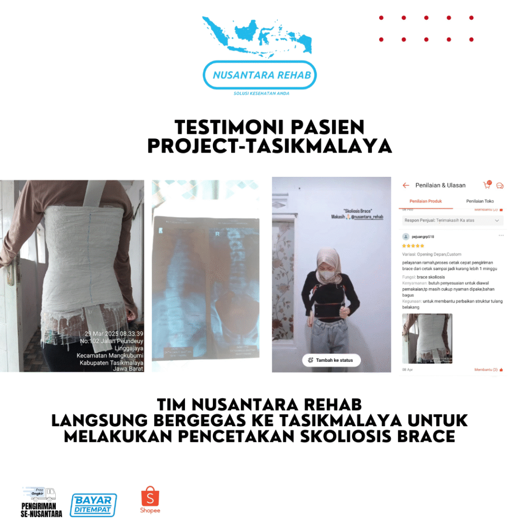 SKOLIOSIS BRACE NUSANTARA REHAB