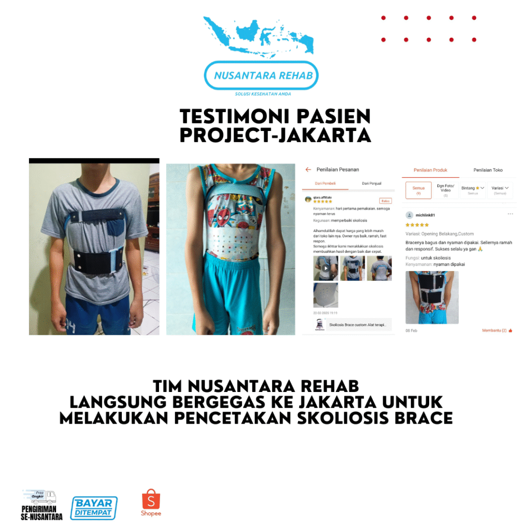SKOLIOSIS BRACE NUSANTARA REHAB
