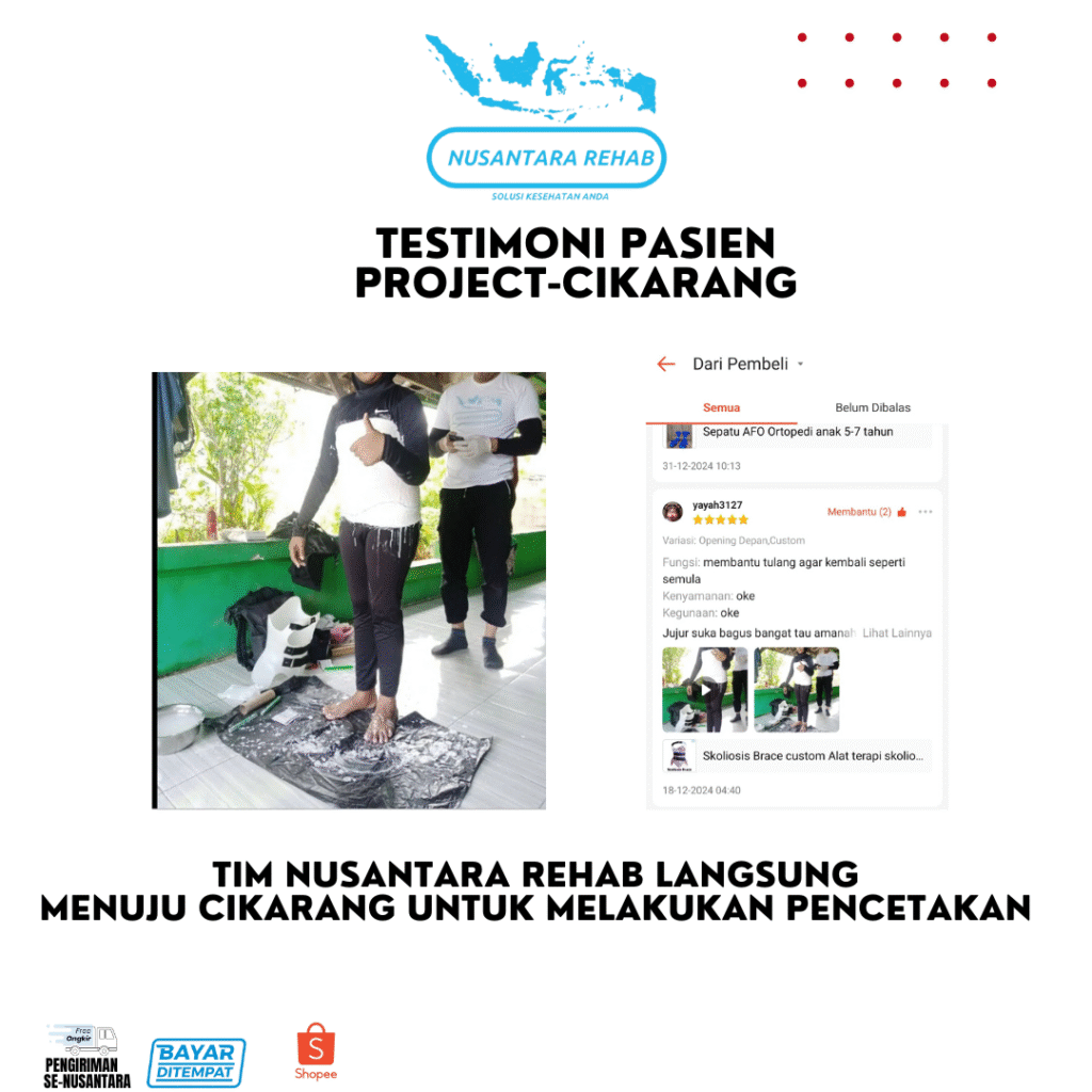 SKOLIOSIS BRACE NUSANTARA REHAB
