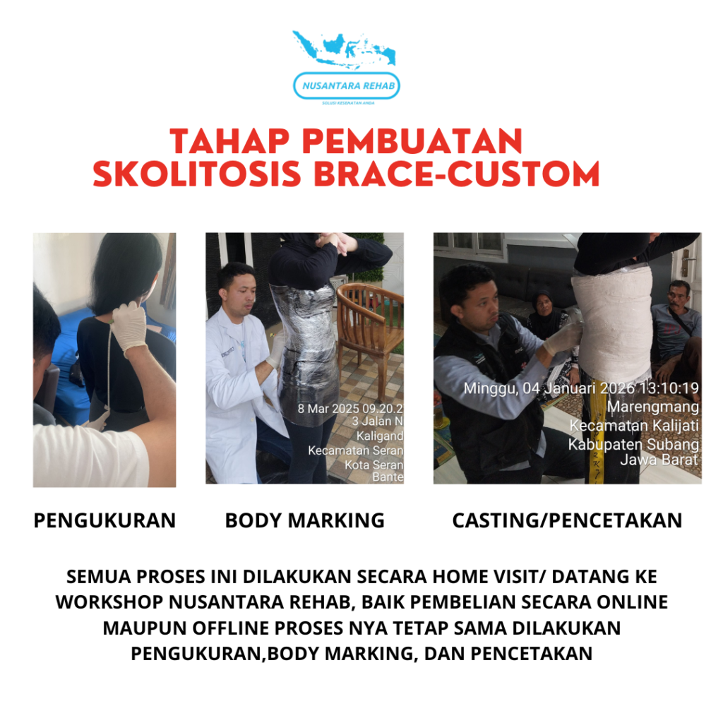 Skoliosis Brace Nusantara Rehab