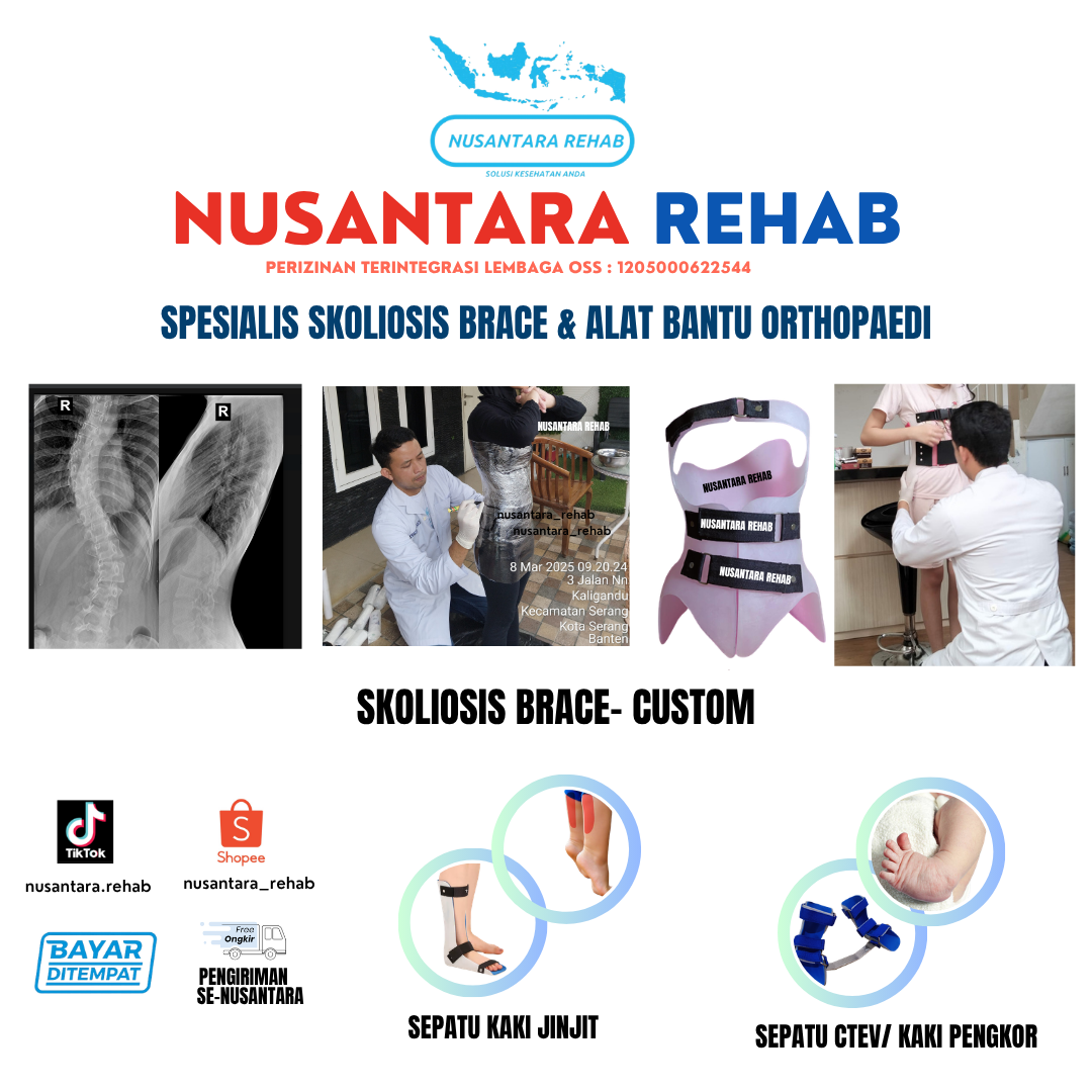 Skoliosis Brace Nusantara Rehab