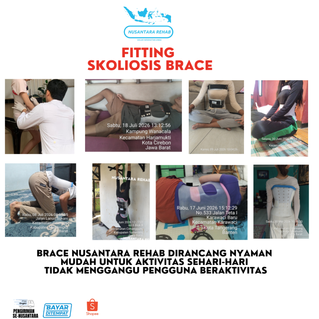 Skoliosis Brace Nusantara Rehab