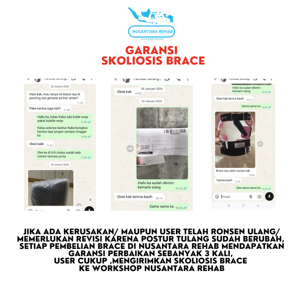 Skoliosis Brace Nusantara Rehab