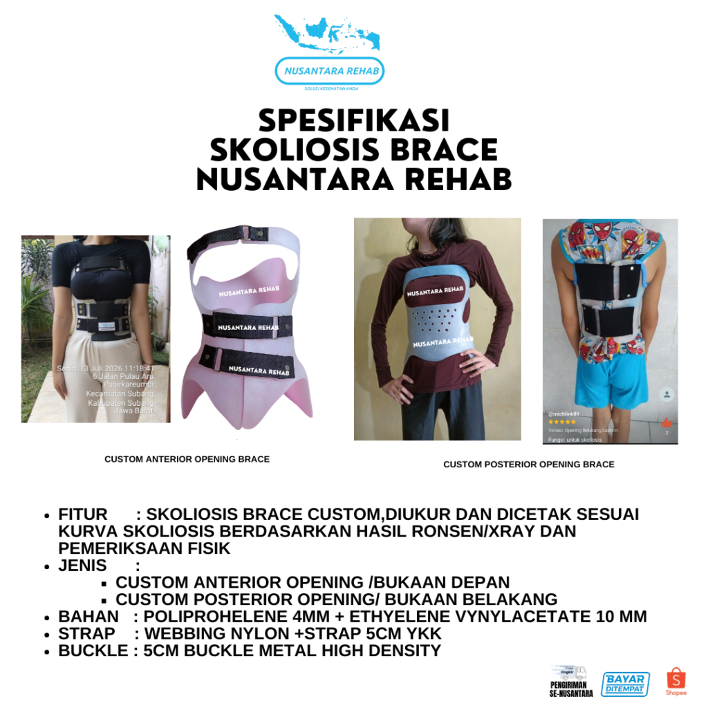 Skoliosis Brace Nusantara Rehab